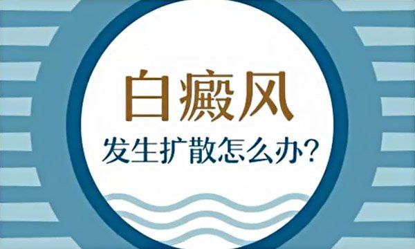 白癜风病情加重是何原因?